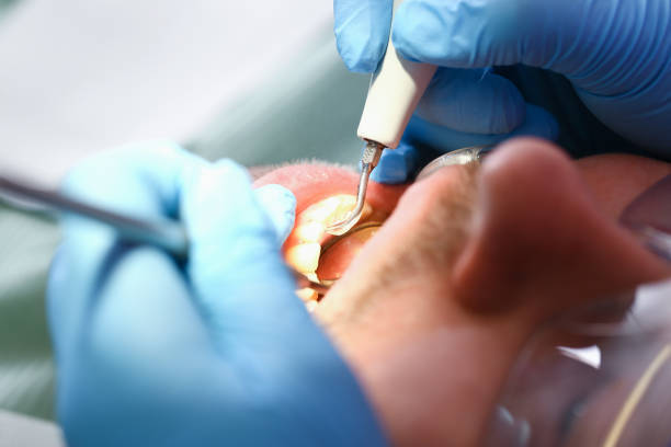 Best Emergency Dental Services for Seniors in Warsaw, NC