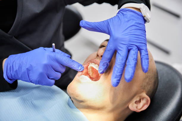 Best Emergency Dental Care for Abscessed Tooth in Warsaw, NC